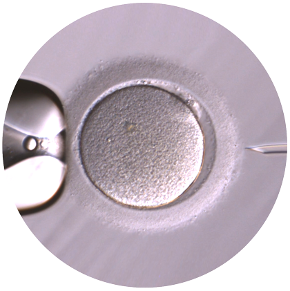 CR-ICSI-inject-embryo-420px